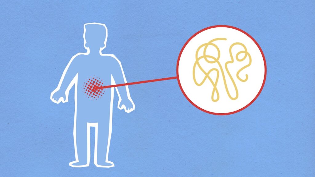 Gut Health